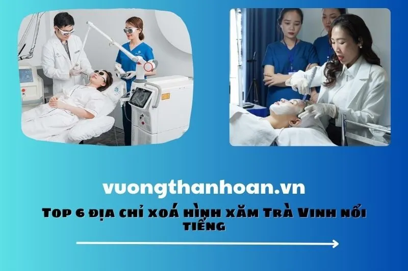 Top 6 địa chỉ xoá hình xăm Trà Vinh nổi tiếng